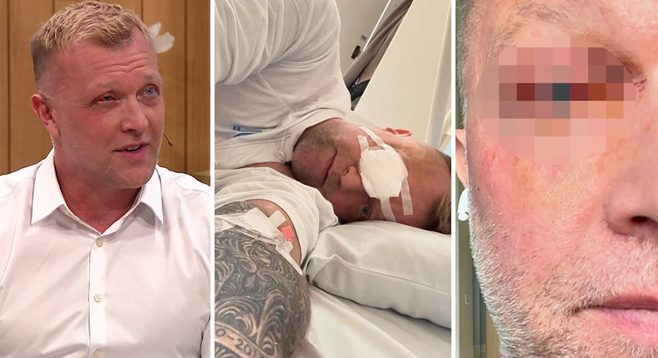 Sverige Fotboll: Hedman drabbad av otäck ögonsjukdom: 